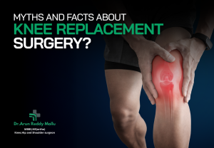 knee replacement surgery in Hyderabad