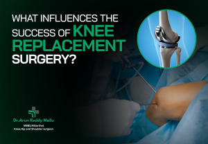 Knee replacement surgery