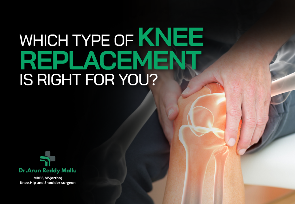 Knee Replacement Surgery in Hyderabad