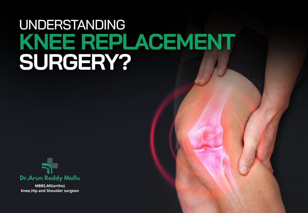 Knee Replacement Surgery