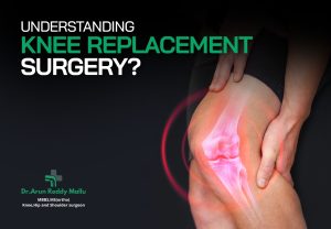 Knee Replacement Surgery
