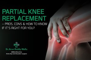 partial knee replacement in Hyderabad