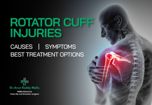 rotator cuff injury treatment in Hyderabad