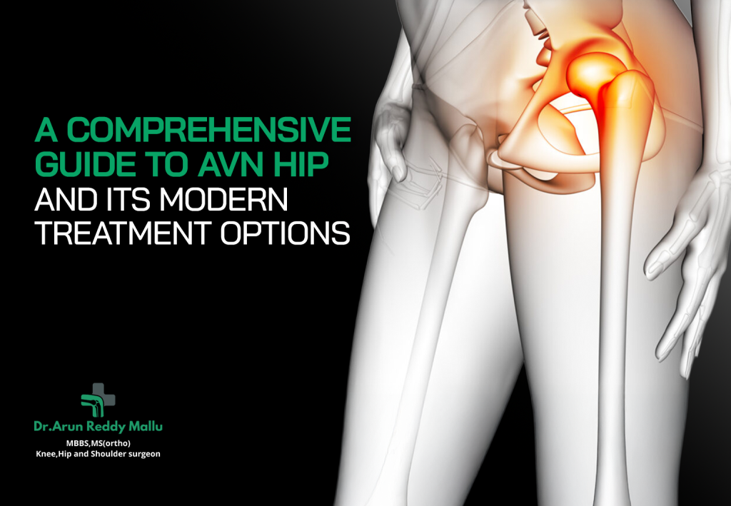 Total Hip Replacement surgery in Hyderabad