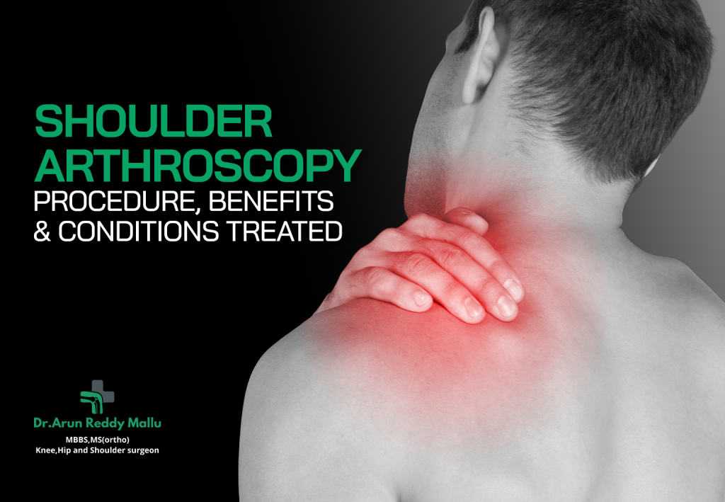 shoulder arthroscopy surgery in hyderabad