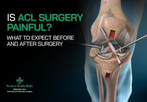 ACL surgery in hyderabad