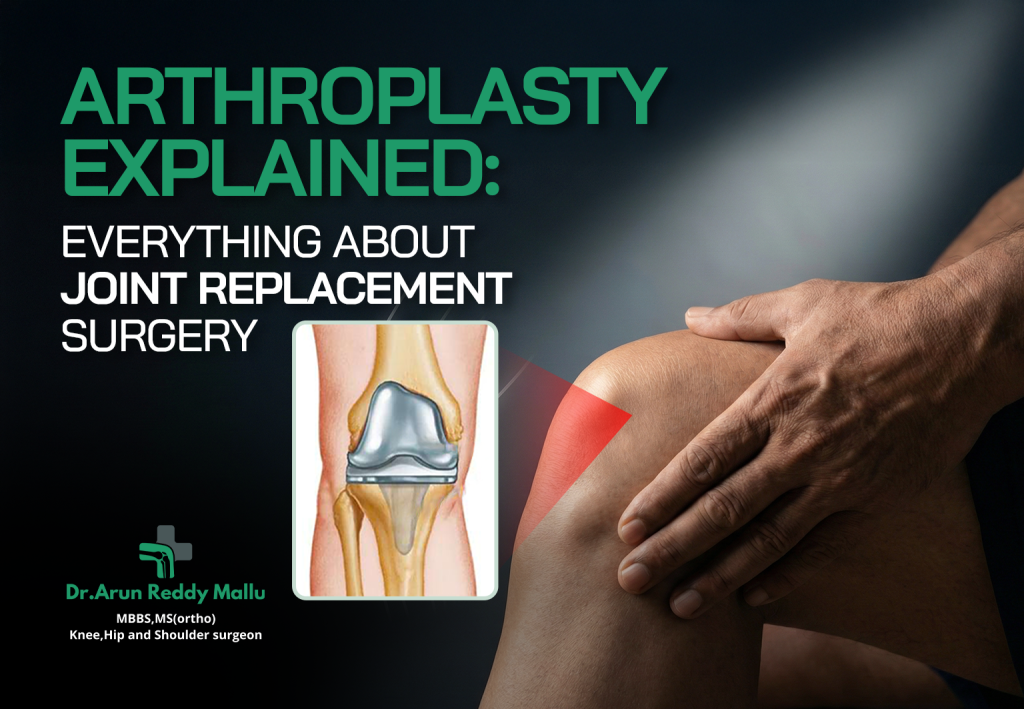 joint replacement surgery
