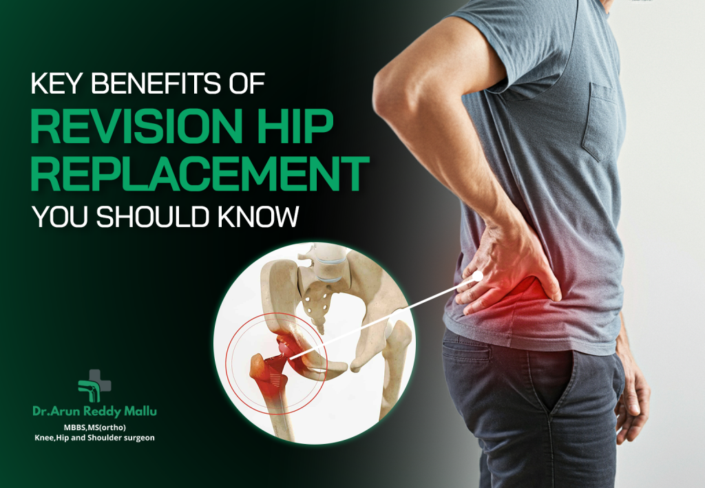 hip replacement surgery