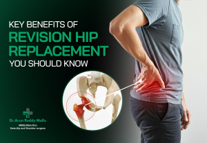 hip replacement surgery