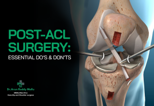 After Acl Surgery Recovery