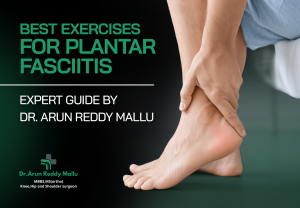 Best Exercises for Plantar Fasciitis
