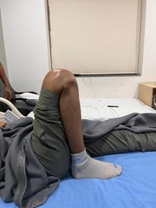 knee instability treatment Hyderabad