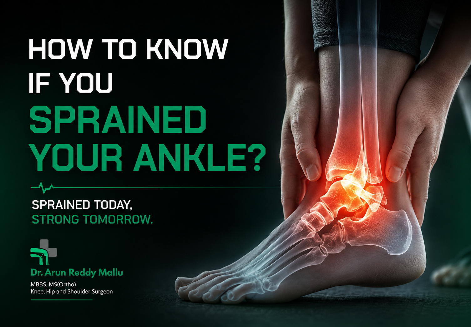 How to Know if You Sprained Your Ankle?