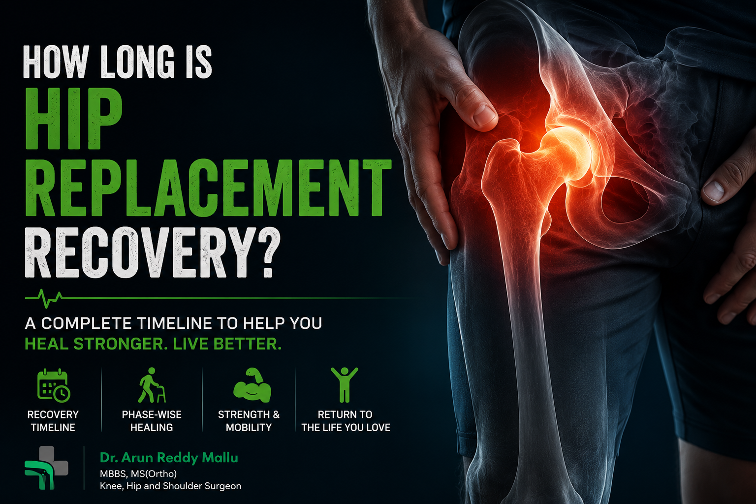 How Long is Hip Replacement Recovery?