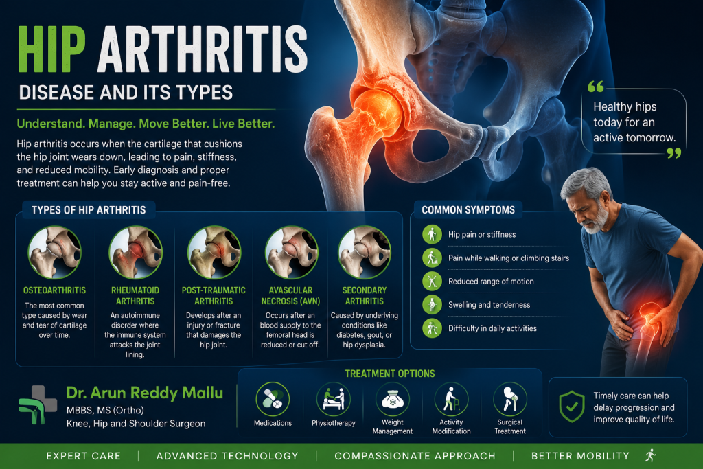 Hip Arthritis – Disease and Its Types | Dr. Arun Reddy Mallu