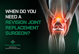 When Do You Need a Revision Joint Replacement Surgeon?