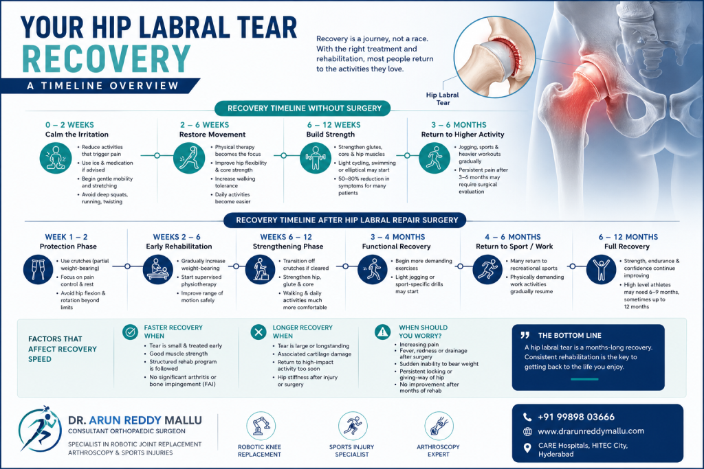 Your Hip Labral Tear Recovery - A Timeline Overview