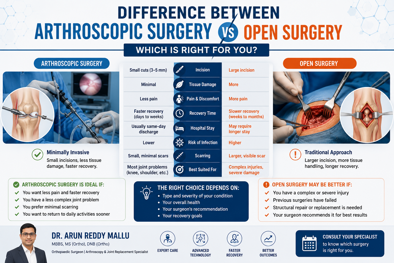 Difference Between Arthroscopic Surgery and Open Surgery - Which Is Right for You?