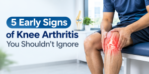 5 Early Signs of Knee Arthritis You Shouldn’t Ignore